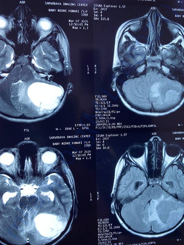MRI2