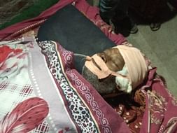 My Uncle Is Struggling With Traumatic Brain Injury, Help Him