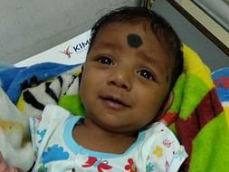2 Months Old Janakirama Needs Your Help Fight Large Perimembranous VSD