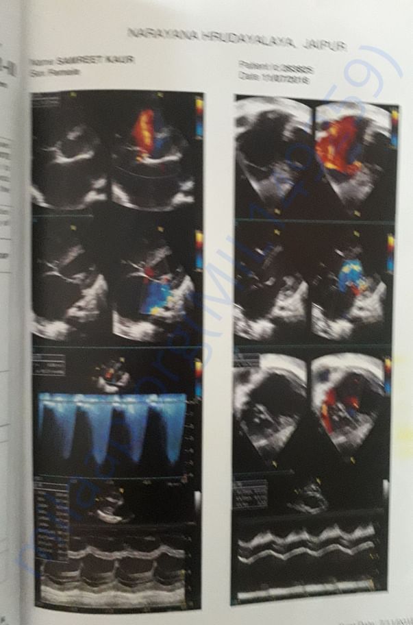x ray report
