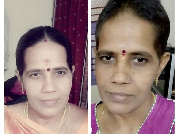 Help my mother fight Carcinoma cervix