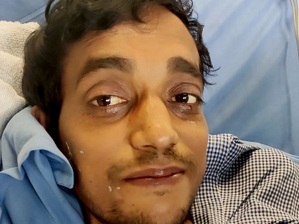 31 Years Old Chetan Kumar Needs Your Help Fight Liver Failure