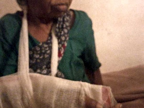 Help Balamma, 80, a destitute, cover surgery costs for fractures
