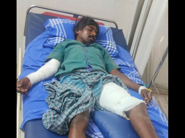 Please help Ramkumar to recover from severe Burns and spinal injury