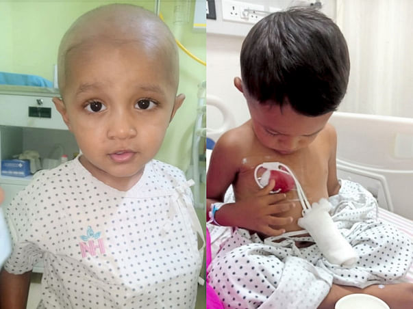Support 2 Years old baby is suffering from rare Thalassemia major.