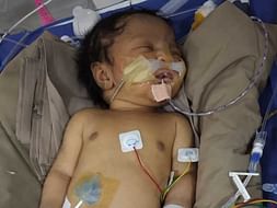 4 Days Baby Of Ishrath Banu Needs Your Help Fight Neuropathic Problems