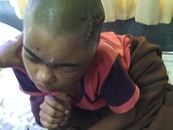 ASSIT A HELPLESS PRIVATE TEACHER SAVE HIS DAUGHTER FROM EPILEPSY