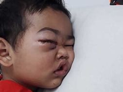 2 Years Old Ridip Karmakar Needs Your Help To Fight For Malignant Cancer