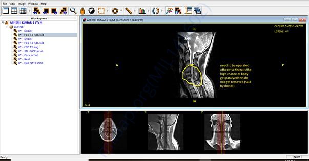 my mri reports