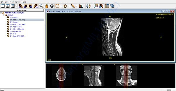 my mri report
