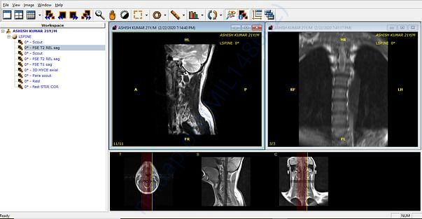 my mri report