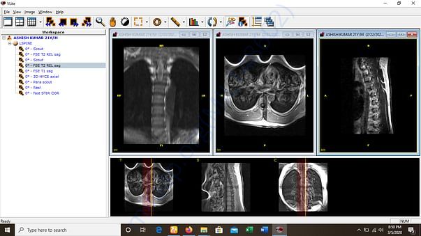 my mri report