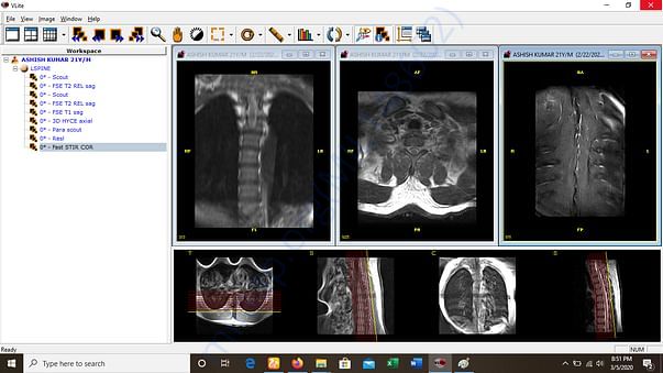 my mri report