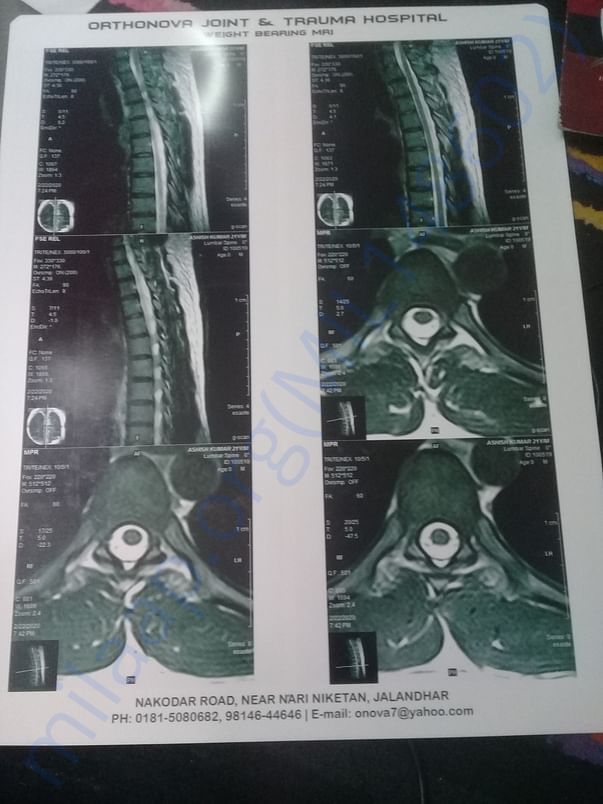my mri report