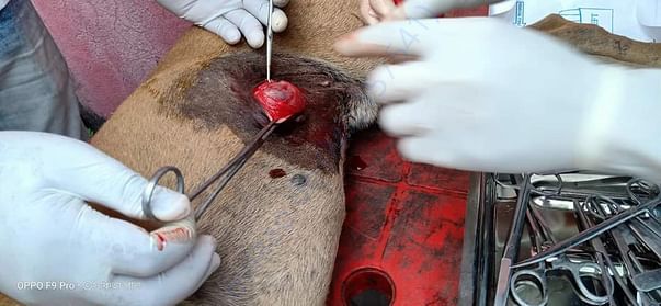 removal of tumor