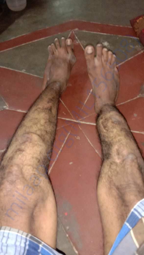 Image of legs