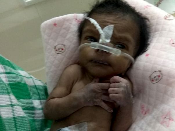 22 Days Old Baby Of Mangalselvi Needs Your Help Fight Cardiac Problem