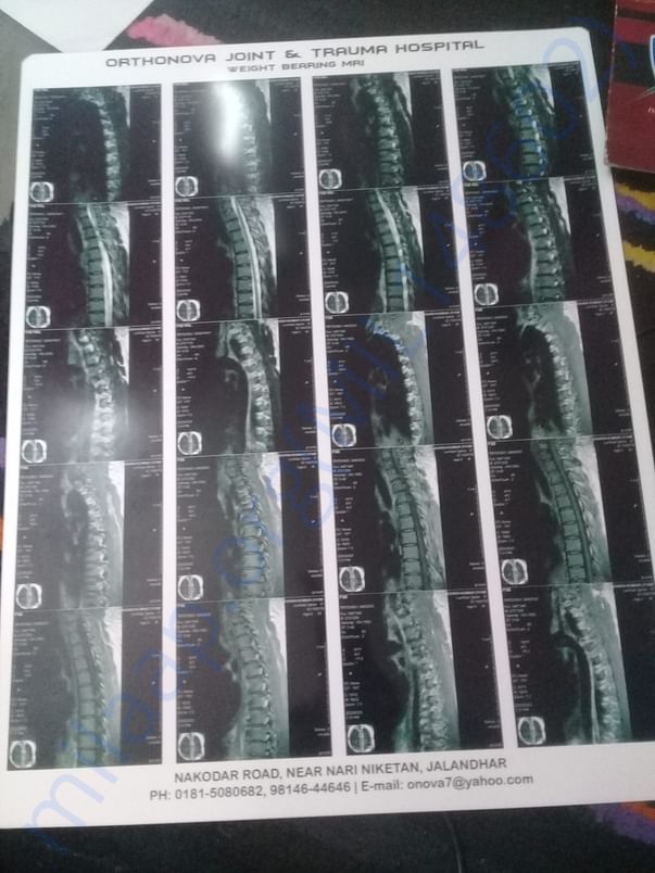 my mri report