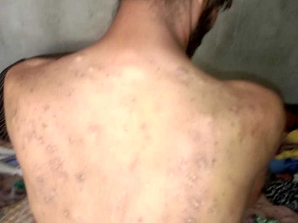 I’m Struggling With Skin Allergy, Help Me