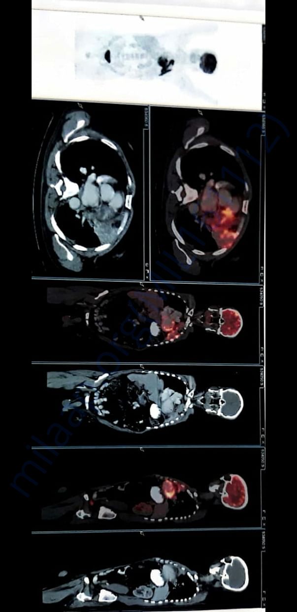 Petscan