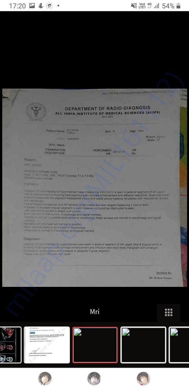 Aiims mri report