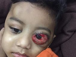Help Goutham Kaloji Fight Blood Cancer, Please save the child