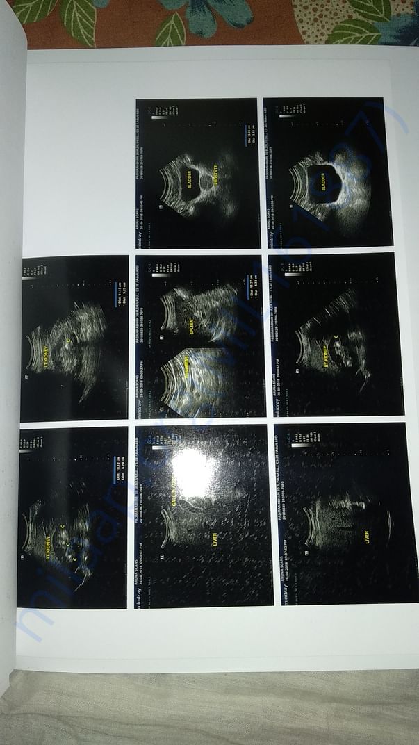 Ultrasound scan
