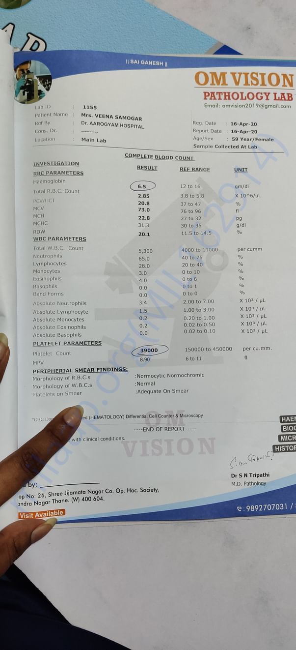 Platelet counts