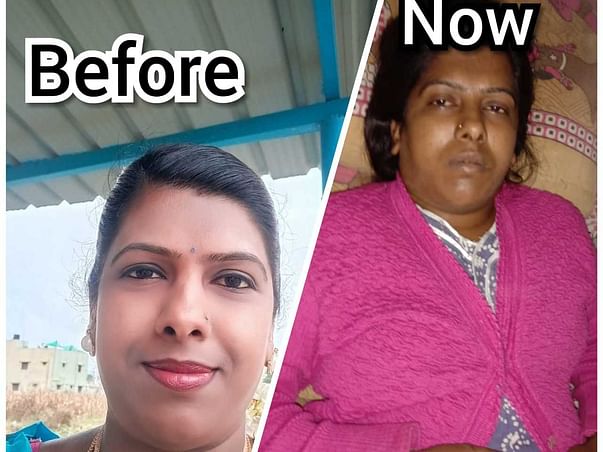 Smitha Needs Your Help Fight Lower Respiratory Tract Infection