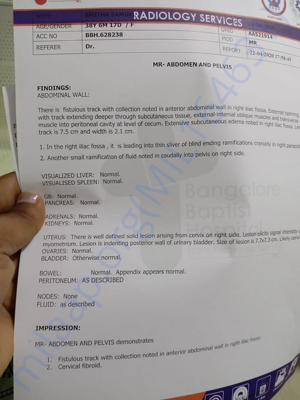 Abdominal scan report