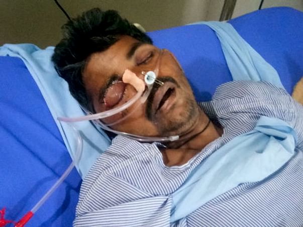 My Friend Veersinghgurgar Is Struggling With Accident, Help Him