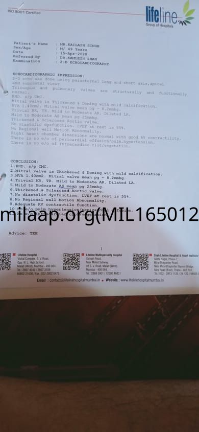 what is utr number in indian bank what is utr number in indian bank