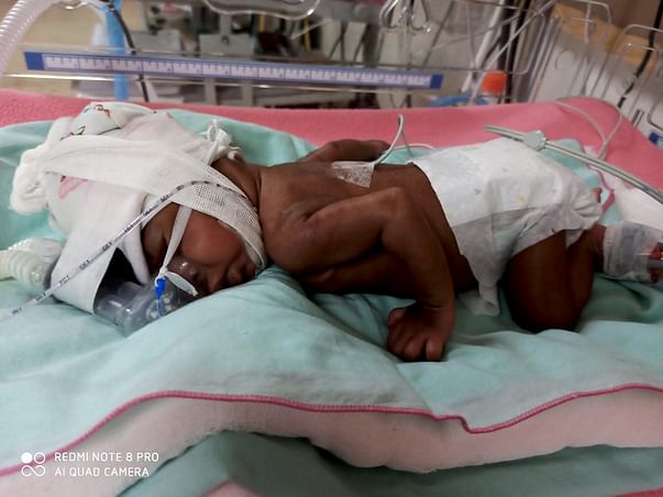 Help Me Save My Premature Twins