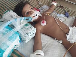 2 Years Old Rashi Needs Your Help Recover Hydrocephalus