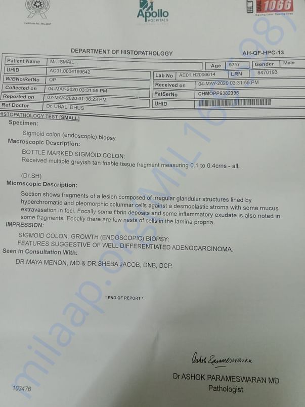 Biopsy