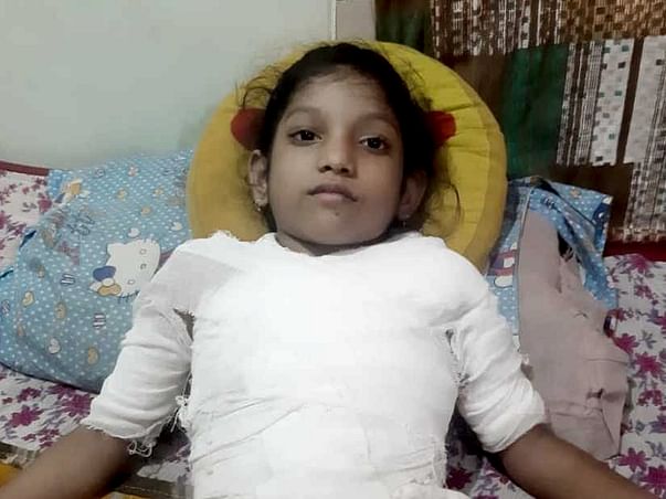 This 7 Years Old Needs Your Urgent Support In Recovering From Body Burn