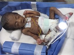 My Daughter Is Struggling With Heart Hole And Preterm Baby , Extremely Low Birth Weight And Respiratory Distress Syndrome, Help Her