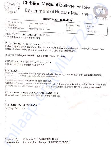 Bone Scintigraphy Report