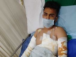 This 20 years old needs your urgent support in fighting Electric burn
