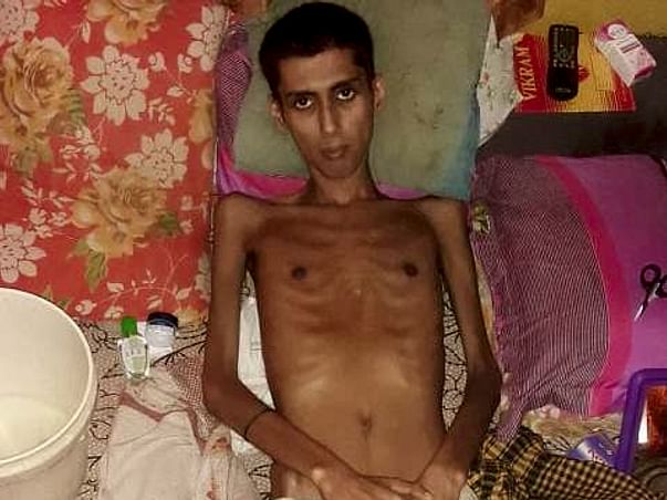 Support Ishan Chatterjee Recover From Pulmonary Tuberculosis