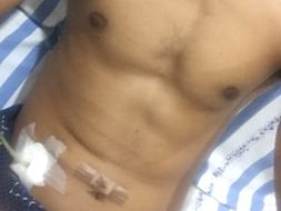 Support Sane Soma Shekar Recover From Appendicitis