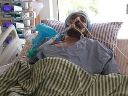 My Cousin Is Struggling With Churg-Strauss Syndrome, Help Him