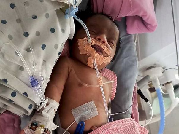 5 Days Old Baby Of Sai Krupa Needs Your Help Fight Polyhydramnios