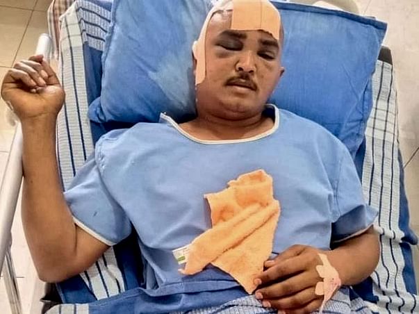 My Friend K V Nageswar Rao Is Struggling With Accident (Head Injury), Help Him