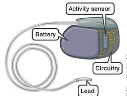 Help heart patients by providing pacemakers for them