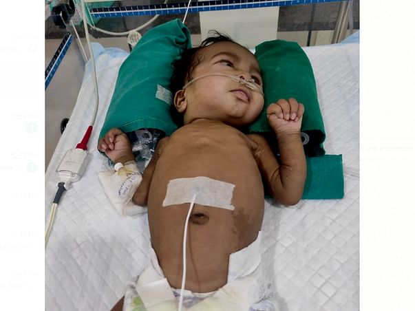 3 Months Old Baby Jenisha Needs Your Help Fight Chronic Lung Disease