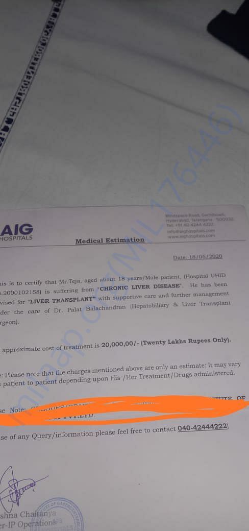 Estimation letter for liver transplantion