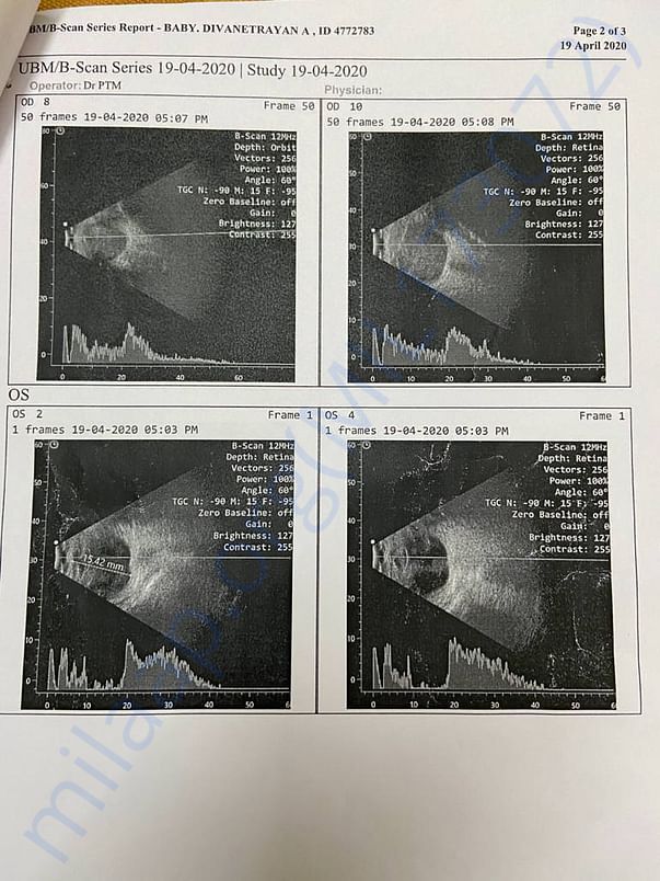 Scan Report