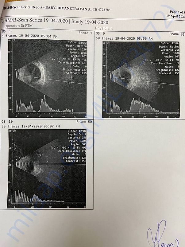 Scan Report
