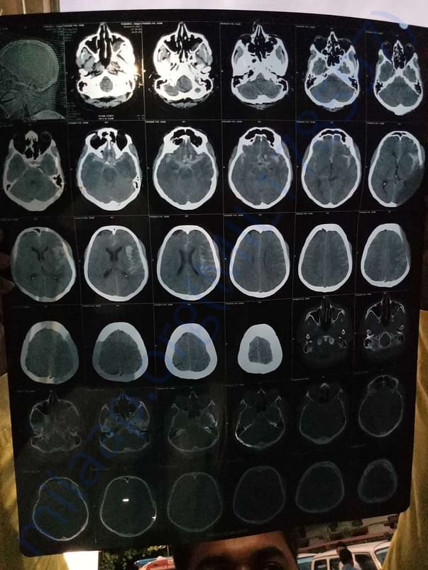 This is the angiogram report 1